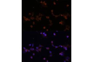 Immunofluorescence analysis of NIH-3T3 cells using UBE2L3 Polyclonal Antibody (ABIN1683196, ABIN3018653, ABIN3018655 and ABIN6220527) at dilution of 1:100 (40x lens). (UBE2L3 anticorps  (AA 73-212))