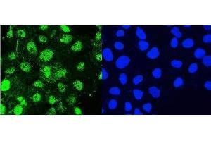 IF analysis of Hsp105 using anti-Hsp105 antibody (ABIN5693036). (HSPH1 anticorps  (AA 653-858))