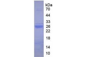 SDS-PAGE of Protein Standard from the Kit (Native TRY protein).
