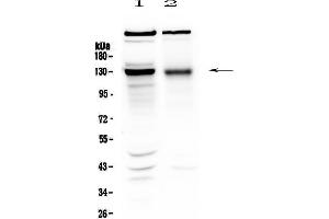 Western blot analysis of BMPR2 using anti-BMPR2 antibody . (BMPR2 anticorps  (AA 455-512))
