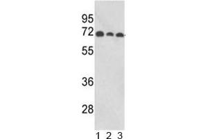 Western blot analysis of ABI1 antibody and human 1) MCF-7, 2) CEM, and 3) Jurkat lysate. (ABI1 anticorps  (AA 81-108))