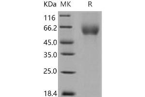 Western Blotting (WB) image for Poliovirus Receptor (PVR) (AA 1-345) (Active) protein (His tag) (ABIN7320344)