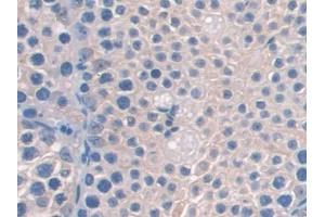 DAB staining on IHC-P; Samples: Mouse Testis Tissue (AASS anticorps  (AA 477-926))