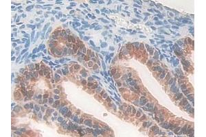 Detection of PDXK in Mouse Oviduct Tissue using Polyclonal Antibody to Pyridoxal Kinase (PDXK)