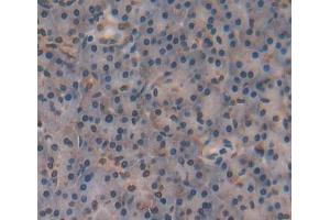 IHC-P analysis of Human Tissue, with DAB staining. (NR5A2 + LRH1 anticorps  (AA 300-541))