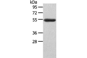 Western Blotting (WB) image for anti-Lymphocyte-Activation Gene 3 (LAG3) antibody (ABIN2431574) (LAG3 anticorps)