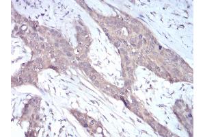 Immunohistochemistry (IHC) image for anti-NADPH Oxidase 4 (NOX4) (AA 210-310) antibody (ABIN5872374) (NADPH Oxidase 4 anticorps  (AA 210-310))