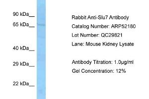 Western Blotting (WB) image for anti-SLU7 Splicing Factor Homolog (SLU7) (Middle Region) antibody (ABIN2774006) (SLU7 anticorps  (Middle Region))