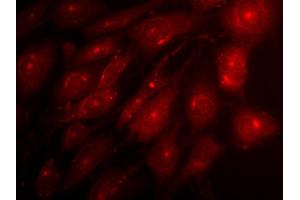 Indirect immunofluorescence on 3T3 cells (dilution 1 : 500) in combination with a Cy3 labeled secondary antibody (dilution 1 : 500). (Syntaxin 12/13 (AA 1-250) anticorps)