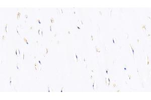 Detection of BMP2 in Bovine Cartilage Tissue using Polyclonal Antibody to Bone Morphogenetic Protein 2 (BMP2)