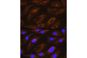 Immunofluorescence analysis of H9C2 cells using NDUF Rabbit pAb (ABIN6132401, ABIN6144467, ABIN6144468 and ABIN6215694) at dilution of 1:100 (40x lens).