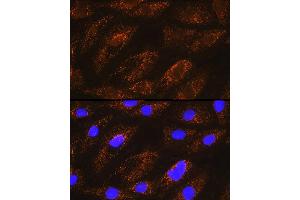 Immunofluorescence analysis of H9C2 cells using NDUF Rabbit pAb (ABIN6132401, ABIN6144467, ABIN6144468 and ABIN6215694) at dilution of 1:100 (40x lens). (NDUFA8 anticorps  (AA 33-172))
