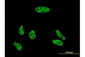 Immunofluorescence of monoclonal antibody to VPS72 on HeLa cell. (VPS72 anticorps  (AA 1-364))