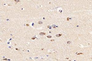 Immunohistochemistry analysis of paraffin-embedded human brain using,PSMD8 (ABIN7075226) at dilution of 1: 2600