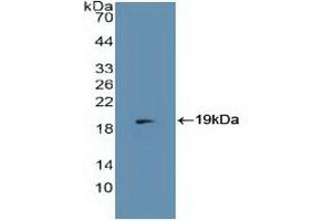 Detection of Recombinant MCP, Human using Polyclonal Antibody to Membrane Cofactor Protein (MCP) (CD46 anticorps  (AA 147-285))