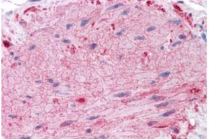 Human Skin, Arrector Pili: Formalin-Fixed, Paraffin-Embedded (FFPE)