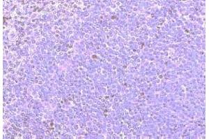 Immunohistochemistry on paraffin section of human spleen (CCRD6 (Extracellular Domain), (N-Term) anticorps)