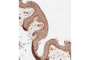 Immunohistochemical analysis of paraffin-embedded human skin tissue using C performed on the Leica® BOND RXm. (ALOXE3 anticorps  (AA 223-252))