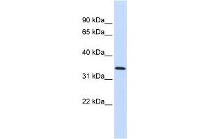 WB Suggested Anti-ANXA4 Antibody Titration:  0. (Annexin IV anticorps  (Middle Region))