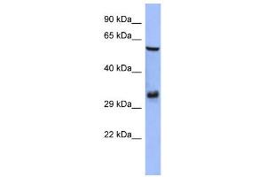 WB Suggested Anti-FOSL1 Antibody Titration:  0. (FOSL1 anticorps  (Middle Region))