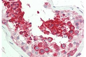 Rabbit Anti-TEX264 antibody  Formalin Fixed Paraffin Embedded Tissue: Human Testis Primary antibody Concentration: 1:100 Secondary Antibody: Donkey anti-Rabbit-Cy3 Secondary Antibody Concentration: 1:200 Magnification: 20x Exposure Time: 0. (TEX264 anticorps  (Middle Region))