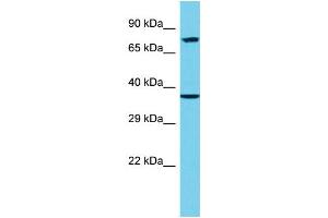 Host: Rabbit Target Name: EPN3 Sample Type: 293T Whole Cell lysates Antibody Dilution: 1.