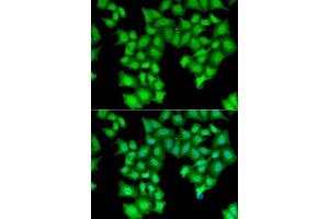 Immunofluorescence analysis of HeLa cells using CPSF3L antibody. (CPSF3L anticorps  (AA 331-600))