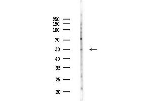 Western blot analysis of lysates from K562 cells(UV,30 min treatment), using CS Antibody at 1/1000 dilution.
