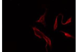 ABIN6275342 staining  Hela cells by IF/ICC. (PARD6B anticorps  (Internal Region))