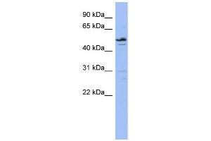 WB Suggested Anti-ZNF419 Antibody Titration:  0. (ZNF419 anticorps  (N-Term))