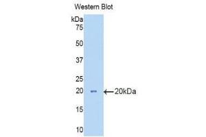 Western Blotting (WB) image for anti-Hexosaminidase B (Beta Polypeptide) (HEXB) (AA 294-435) antibody (ABIN1859138) (HEXB anticorps  (AA 294-435))
