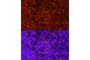 Immunofluorescence (IF) image for anti-Lymphoid Enhancer-Binding Factor 1 (LEF1) (AA 100-399) antibody (ABIN5663810)