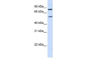 Western Blotting (WB) image for anti-Solute Carrier Family 27 (Fatty Acid Transporter), Member 4 (SLC27A4) antibody (ABIN2458790)