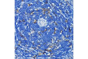 Immunohistochemistry of paraffin-embedded rat spleen using TNFR1/TNFRSF1A Rabbit pAb (ABIN3022103, ABIN3022104, ABIN1513619 and ABIN6218606) at dilution of 1:100 (40x lens).