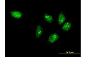 Immunofluorescence of monoclonal antibody to MTA3 on HeLa cell. (MTA3 anticorps  (AA 416-515))