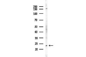 anti-Growth Arrest and DNA-Damage-Inducible, alpha (GADD45A) (N-Term) antibody