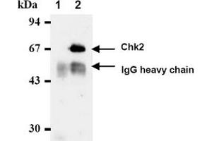 Western Blotting (WB) image for anti-Checkpoint Kinase 2 (CHEK2) antibody (ABIN487312) (CHEK2 anticorps)