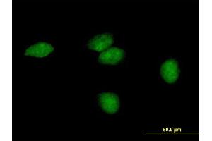 Immunofluorescence of purified MaxPab antibody to FLJ35220 on HeLa cell. (Endonuclease V anticorps  (AA 1-264))