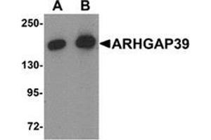 Western blot analysis of ARHGAP39 in A20 cell lysate with ARHGAP39 Antibody  at (A) 1 and (B) 2 μg/ml. (ARHGAP39 anticorps  (C-Term))
