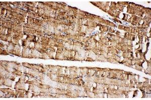 Anti-VDAC/Porin antibody, IHC(P) IHC(P): Rat Skeletal Muscle Tissue