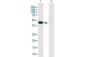Western Blot analysis of CRELD1 expression in transfected 293T cell line by CRELD1 MaxPab polyclonal antibody. (CRELD1 anticorps  (AA 1-422))
