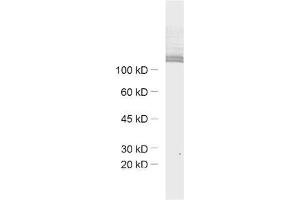 dilution: 1 : 1000, sample: mouse retina extract (Ribeye (AA 95-207) anticorps)