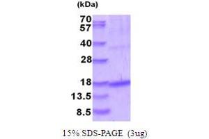 Growth Differentiation Factor 5 (GDF5) (AA 376-495) protein (His tag)