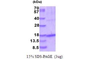SDS-PAGE (SDS) image for Growth Differentiation Factor 5 (GDF5) (AA 376-495) protein (His tag) (ABIN5853985) (GDF5 Protein (AA 376-495) (His tag))