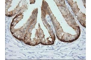 Immunohistochemical staining of paraffin-embedded Human prostate tissue using anti-CRYM mouse monoclonal antibody. (CRYM anticorps)