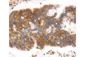 Immunohistochemistry (IHC) image for anti-Afadin (MLLT4) antibody (ABIN2432053) (Afadin anticorps)