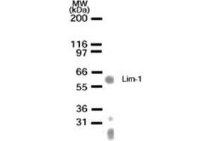 Image no. 1 for anti-LIM Homeobox 1 (LHX1) (AA 149-165) antibody (ABIN233117) (LHX1 anticorps  (AA 149-165))