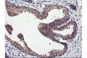 Image no. 1 for anti-Chromosome X Open Reading Frame 26 (CXorf26) antibody (ABIN1497690) (CXorf26 anticorps)