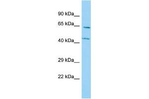 Host: Rabbit Target Name: P4HA3 Sample Type: A549 Whole Cell lysates Antibody Dilution: 1. (P4HA3 anticorps  (N-Term))