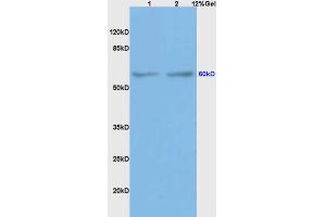BMPR1A antibody  (AA 101-200)